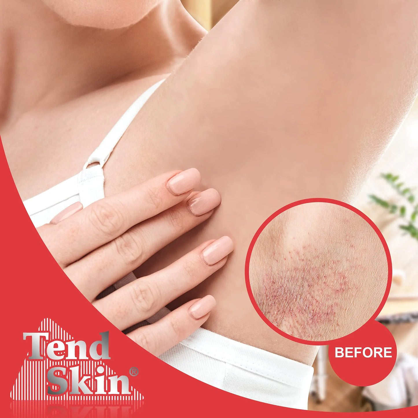 Tend Skin The Skin Care Solution For Unsightly Razor Bumps