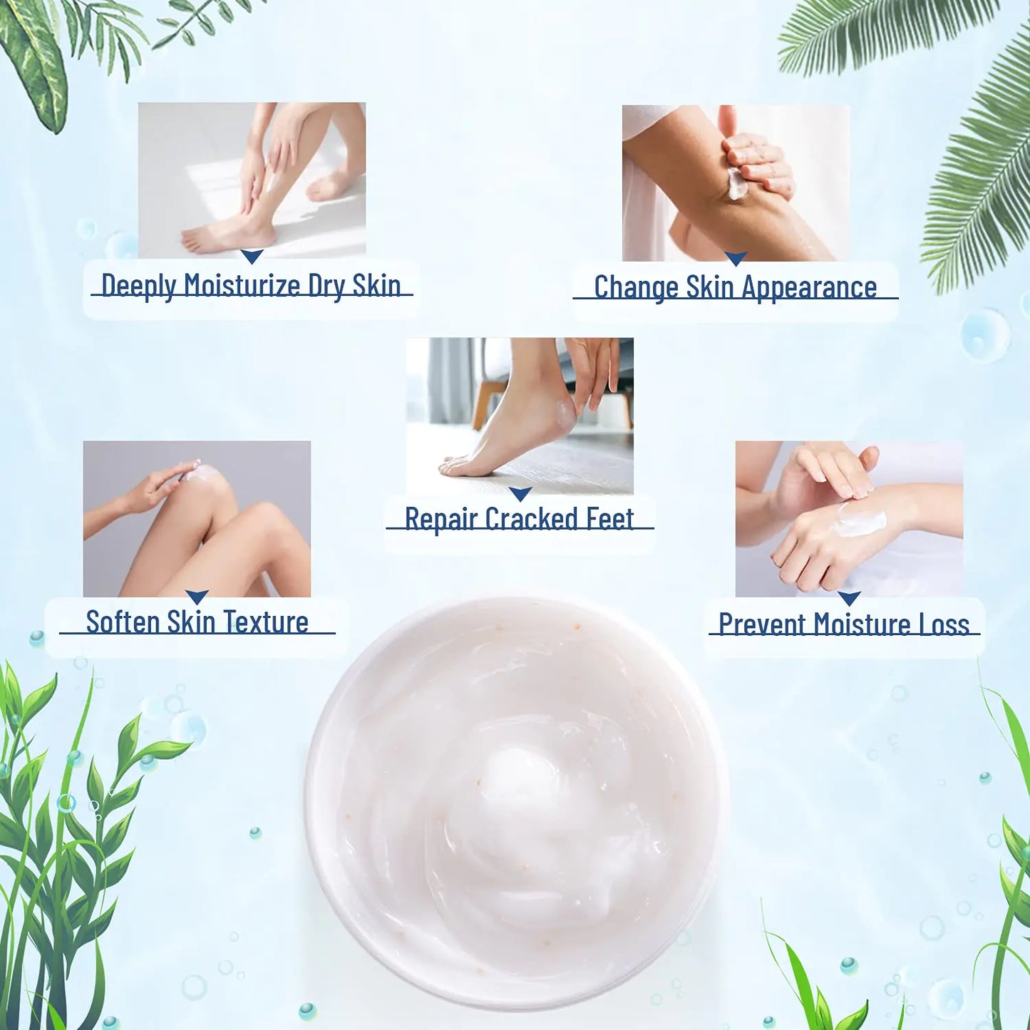 Urea Cream 40 Percent