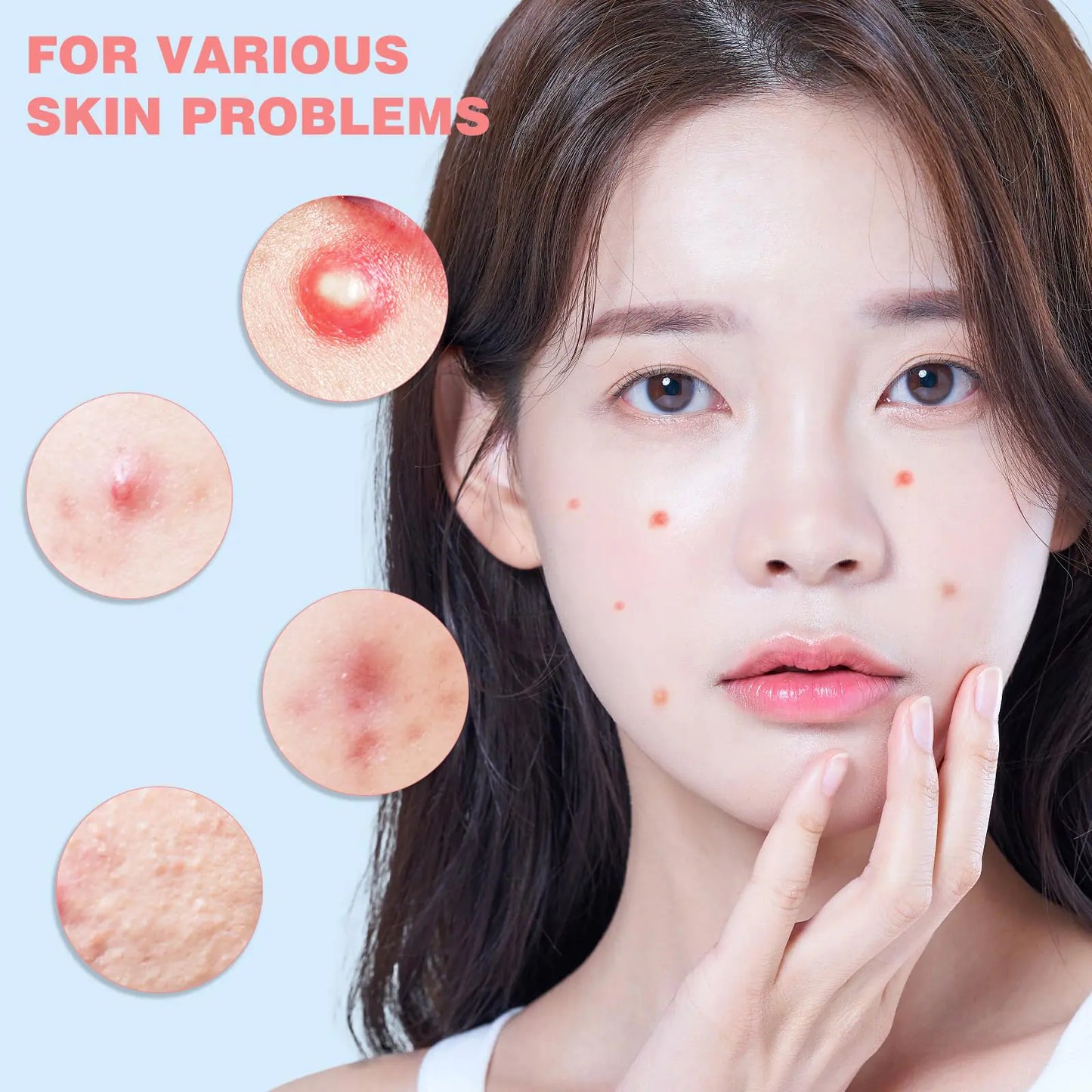 Pimple Patches for Face 360PCS