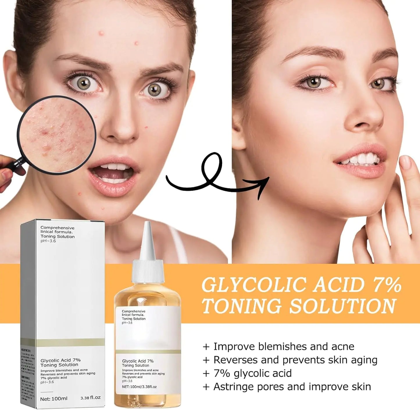 240ML Glycolic Acid 7% Toner,Glycolic Sour 7%